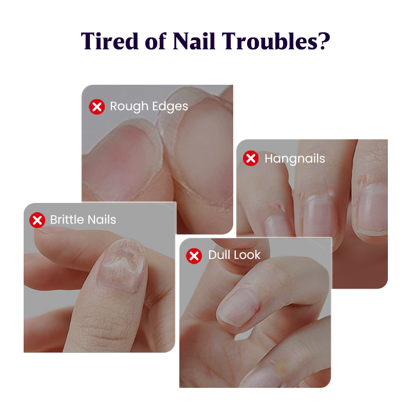 💜New Upgraded 3-in-1 Nail Care Pen💅