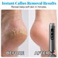 🥳27,000 RPM Electric Foot Renewal – 5 speeds, disposable pads. No scrubbing, salon smooth at home. 🦶✨
